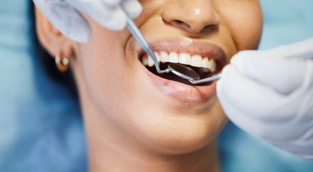 Best Emergency Dentist for Knocked-Out Tooth in Moores Mill, AL