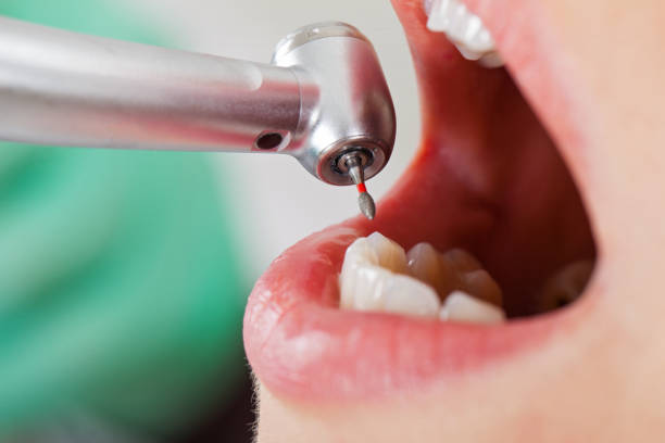 Best Emergency Dental Services for Seniors in Moores Mill, AL